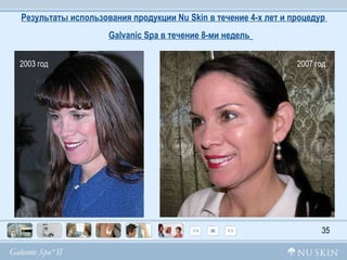 Результаты использования продукции  Nu Skin  в течение 4-х лет и процедур  Galvanic Sp а в течение 8-ми недель   35 2003 год 2007 год 