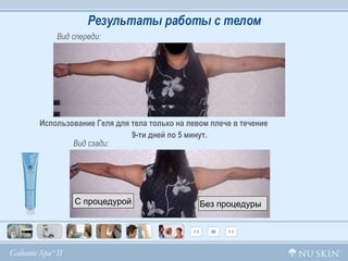 Без процедуры   С процедурой Вид спереди: Вид сзади : Использование Геля для тела только на левом плече в течение  9-ти дней по 5 минут. Результаты работы с телом С процедурой Без процедуры   