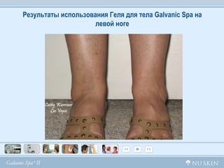 Результаты использования Геля для тела  Galvanic Spa  на левой ноге 