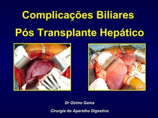 Complicações Biliares
Pós Transplante Hepático
Dr Ozimo GamaDr Ozimo Gama
Cirurgia do Aparelho DigestivoCirurgia do Aparelho Digestivo
 