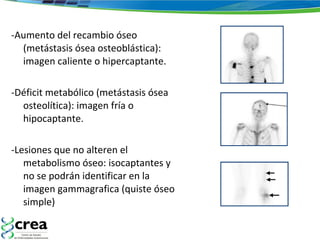 -Aumento del recambio óseo (metástasis ósea osteoblástica): imagen caliente o hipercaptante.  -Déficit metabólico (metástasis ósea osteolítica): imagen fría o hipocaptante.  -Lesiones que no alteren el metabolismo óseo: isocaptantes y no se podrán identificar en la imagen gammagrafica (quiste óseo simple) 
