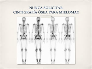 NUNCA SOLICITAR ! 
CINTIGRAFÍA ÓSEA PARA MIELOMA!! 
 