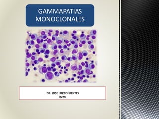 GAMMAPATIAS
MONOCLONALES
DR. JOSE LOPEZ FUENTES
R2MI
 