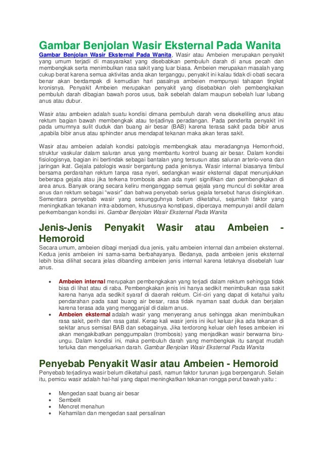  Gambar  benjolan wasir eksternal pada wanita