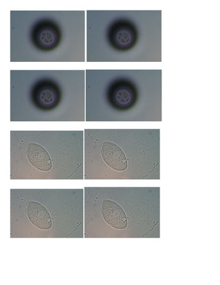Gambar praktikum protozoa