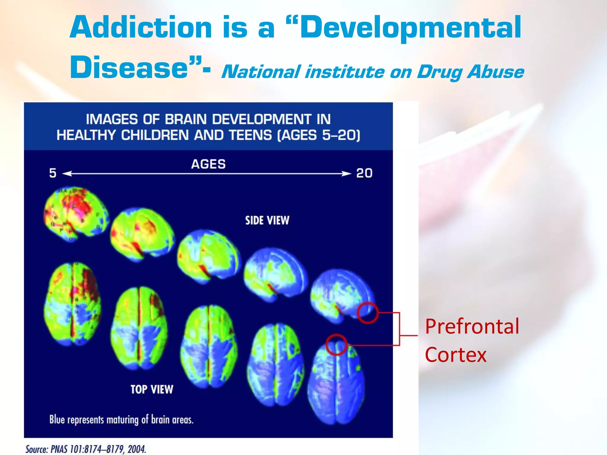 Addiction is a “Developmental
Disease”- National institute on Drug Abuse




                                Prefrontal
                                Cortex
 