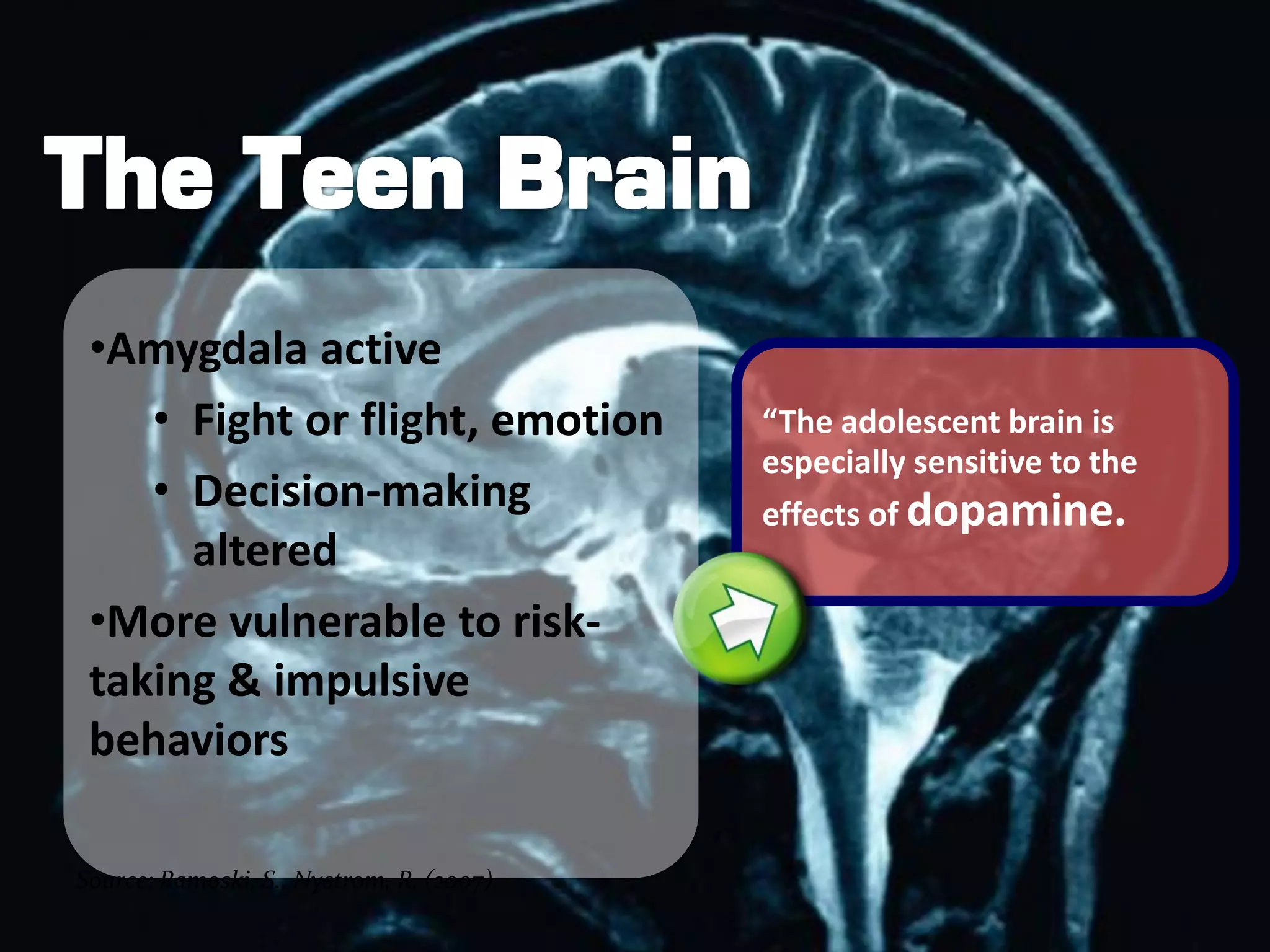 •Amygdala active
    • Fight or flight, emotion             “The adolescent brain is
                                           especially sensitive to the
    • Decision-making                      effects of dopamine.
      altered
 •More vulnerable to risk-
 taking & impulsive
 behaviors

Source: Ramoski, S., Nystrom, R. (2007).
 