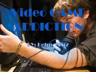 Video GAME
ADDICTION
BY: Belny Cruz
 