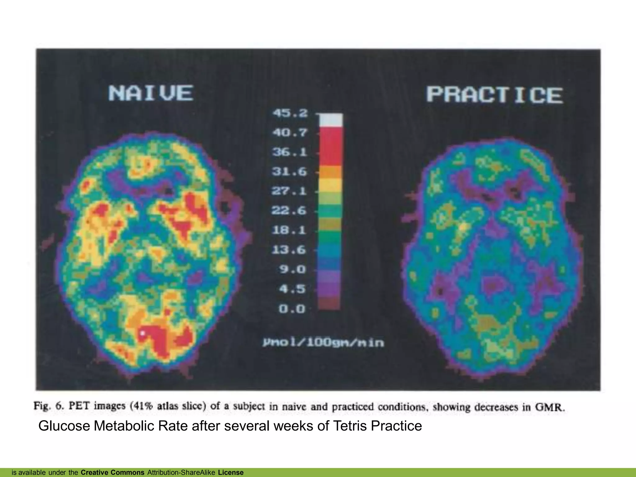 Glucose Metabolic Rate after several weeks of Tetris Practice


is available under the Creative Commons Attribution-ShareAlike License
 