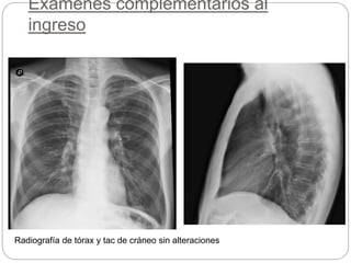 Exámenes complementarios al
ingreso
Radiografía de tórax y tac de cráneo sin alteraciones
 