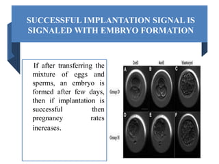 SUCCESSFUL IMPLANTATION SIGNAL IS
SIGNALED WITH EMBRYO FORMATION
If after transferring the
mixture of eggs and
sperms, an embryo is
formed after few days,
then if implantation is
successful then
pregnancy rates
increases.
 