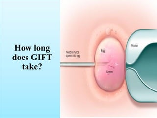 How long
does GIFT
take?
 