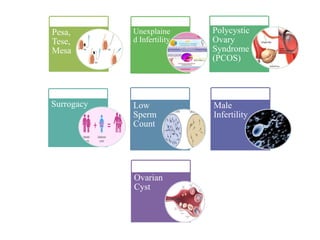 Pesa,
Tese,
Mesa
Unexplaine
d Infertility
Polycystic
Ovary
Syndrome
(PCOS)
Surrogacy Low
Sperm
Count
Male
Infertility
Ovarian
Cyst
 