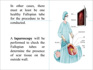 In other cases, there
must at least be one
healthy Fallopian tube
for the procedure to be
conducted.
A laparoscopy will be
performed to check the
Fallopian tubes or
determine the presence
of scar tissue on the
outside wall.
 
