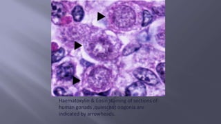 Haematoxylin & Eosin staining of sections of
human gonads ,quiescent oogonia are
indicated by arrowheads.
 