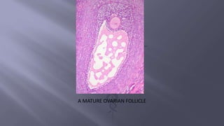 A MATURE OVARIAN FOLLICLE
 