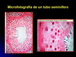 Microfotografía de un tubo seminífero 