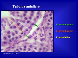 Túbulo seminífero




                                Espermatogonias

                                Espermatocitos I

                                Espermátidas




Preparado Nº 95 (HyE)
 