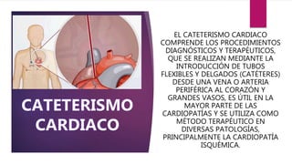 EL CATETERISMO CARDIACO
COMPRENDE LOS PROCEDIMIENTOS
DIAGNÓSTICOS Y TERAPÉUTICOS,
QUE SE REALIZAN MEDIANTE LA
INTRODUCCIÓN DE TUBOS
FLEXIBLES Y DELGADOS (CATÉTERES)
DESDE UNA VENA O ARTERIA
PERIFÉRICA AL CORAZÓN Y
GRANDES VASOS, ES ÚTIL EN LA
MAYOR PARTE DE LAS
CARDIOPATÍAS Y SE UTILIZA COMO
MÉTODO TERAPÉUTICO EN
DIVERSAS PATOLOGÍAS,
PRINCIPALMENTE LA CARDIOPATÍA
ISQUÉMICA.
 