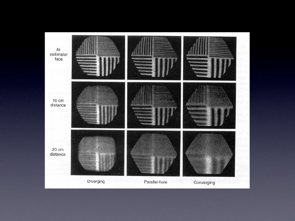 Gamma Camera Image Quality