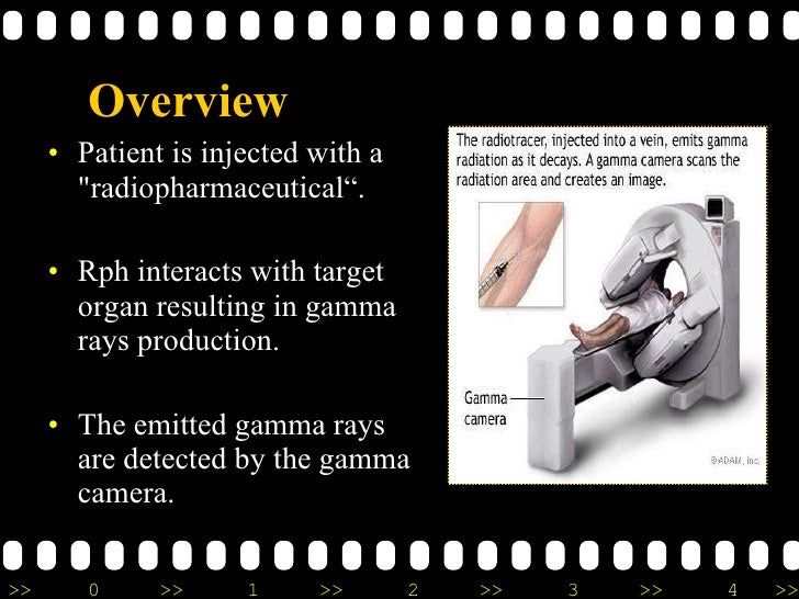 Energy resolution of gamma camera image