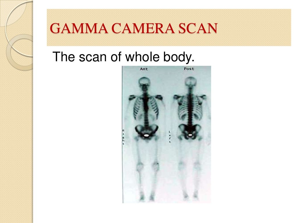 Gamma Camera