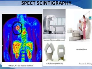 SPECT SCINTIGRAPHY
 