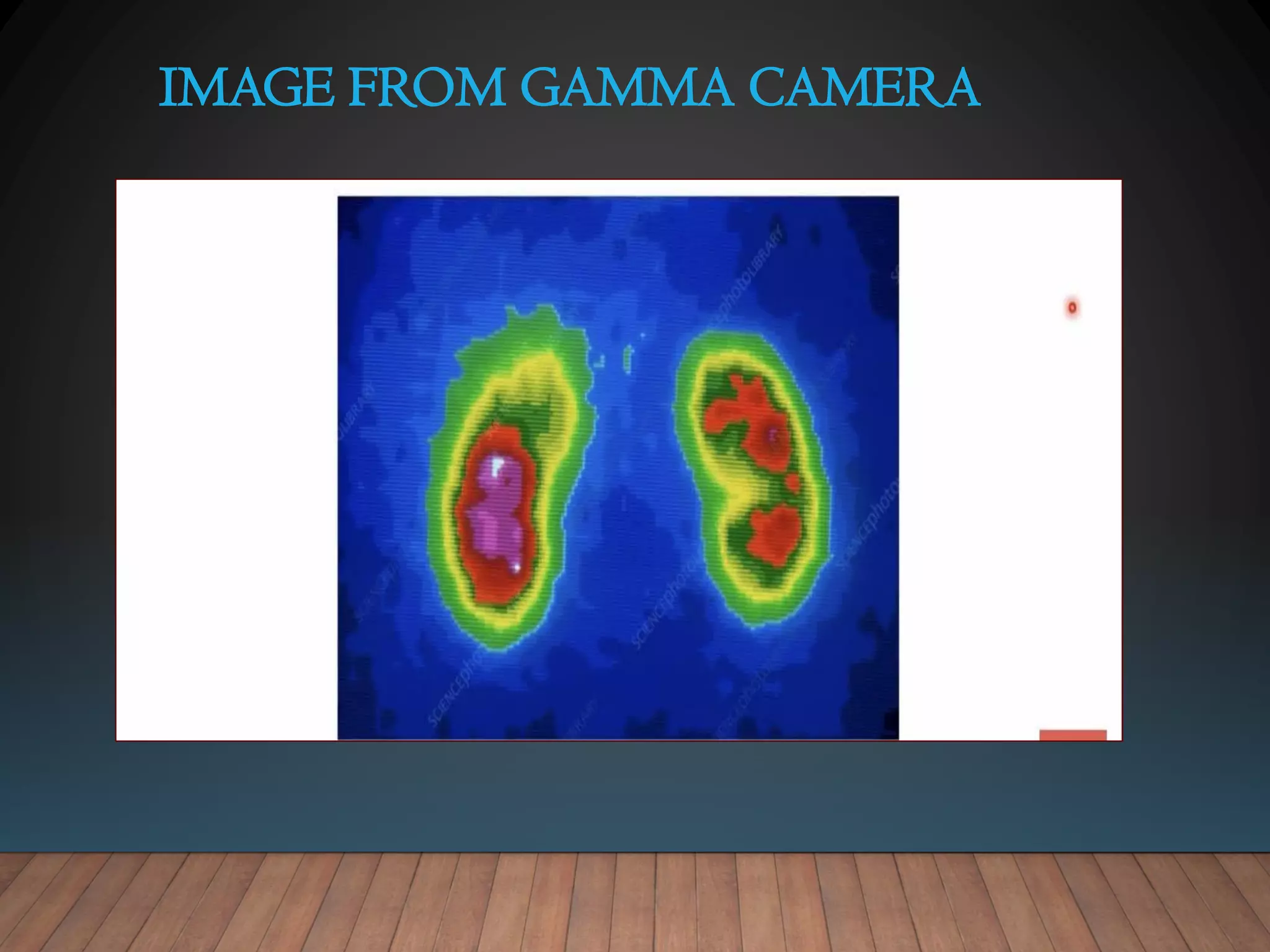 IMAGE FROM GAMMA CAMERA
 
