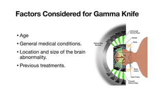 Factors Considered for Gamma Knife
• Age
• General medical conditions.
• Location and size of the brain
abnormality.
• Previous treatments.
 