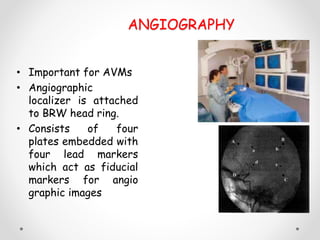 GAMMA KNIFE , X-KNIFE AND CYBERKNIFE | PPTX