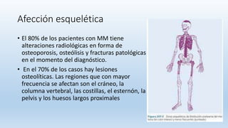 Afección esquelética
• El 80% de los pacientes con MM tiene
alteraciones radiológicas en forma de
osteoporosis, osteólisis y fracturas patológicas
en el momento del diagnóstico.
• En el 70% de los casos hay lesiones
osteolíticas. Las regiones que con mayor
frecuencia se afectan son el cráneo, la
columna vertebral, las costillas, el esternón, la
pelvis y los huesos largos proximales
 