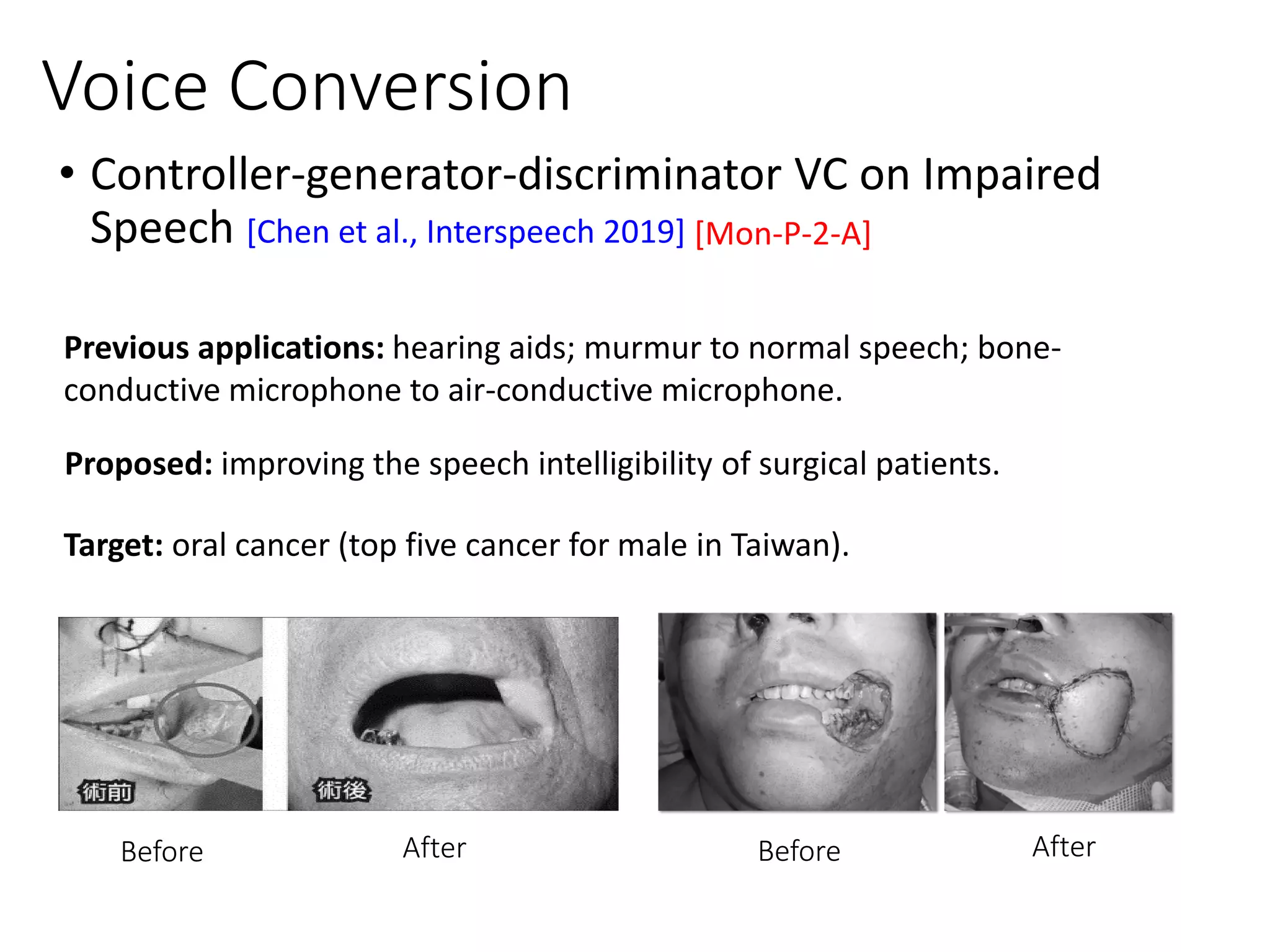 • Controller-generator-discriminator VC on Impaired
Speech [Chen et al., Interspeech 2019]
Voice Conversion
Previous applications: hearing aids; murmur to normal speech; bone-
conductive microphone to air-conductive microphone.
Before
Proposed: improving the speech intelligibility of surgical patients.
Target: oral cancer (top five cancer for male in Taiwan).
After Before After
[Mon-P-2-A]
 