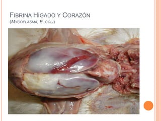 FIBRINA HÍGADO Y CORAZÓN
(MYCOPLASMA, E. COLI)
 