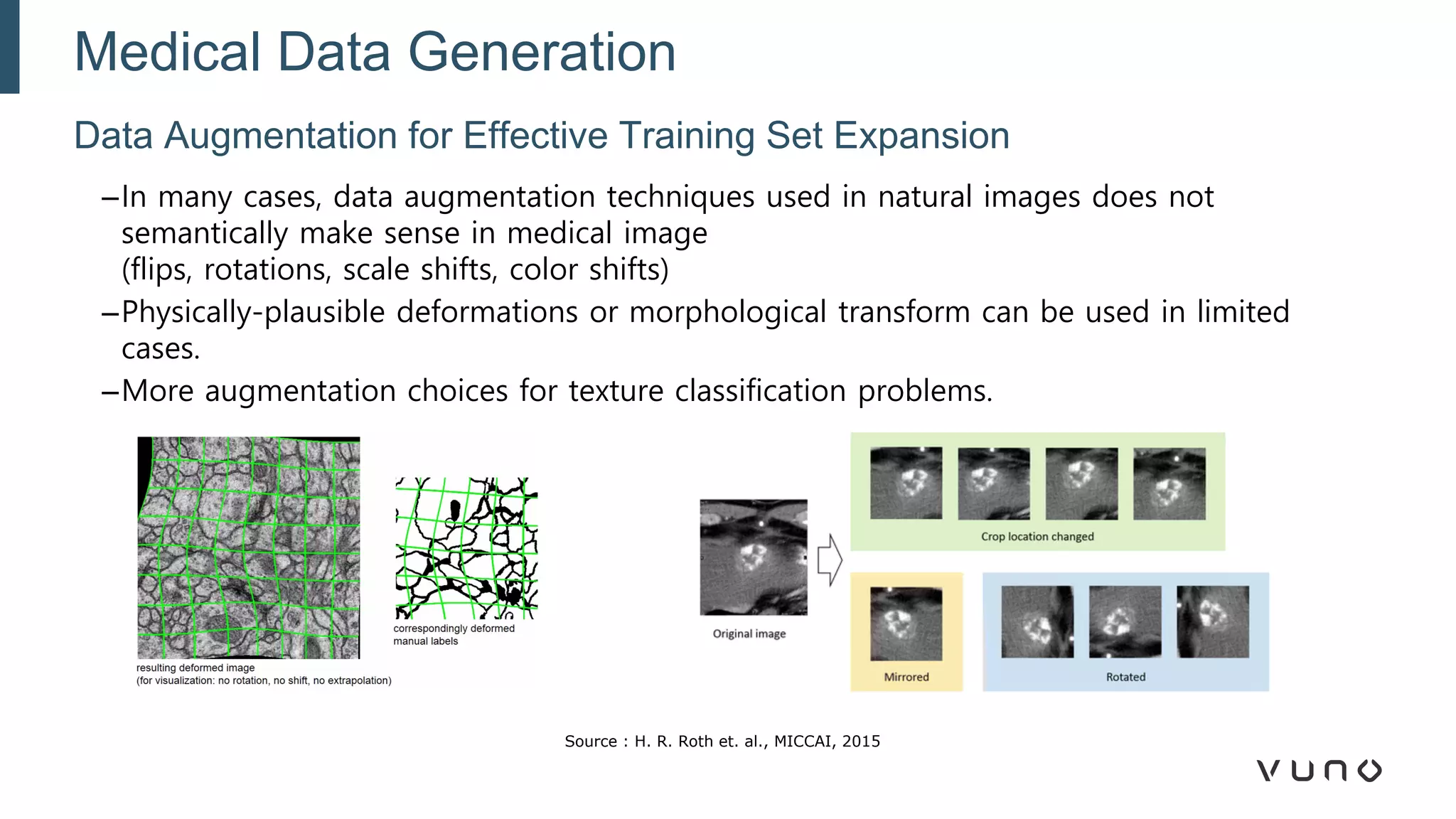 –In many cases, data augmentation techniques used in natural images does not
semantically make sense in medical image
(flips, rotations, scale shifts, color shifts)
–Physically-plausible deformations or morphological transform can be used in limited
cases.
–More augmentation choices for texture classification problems.
Data Augmentation for Effective Training Set Expansion
Medical Data Generation
Source : H. R. Roth et. al., MICCAI, 2015
 