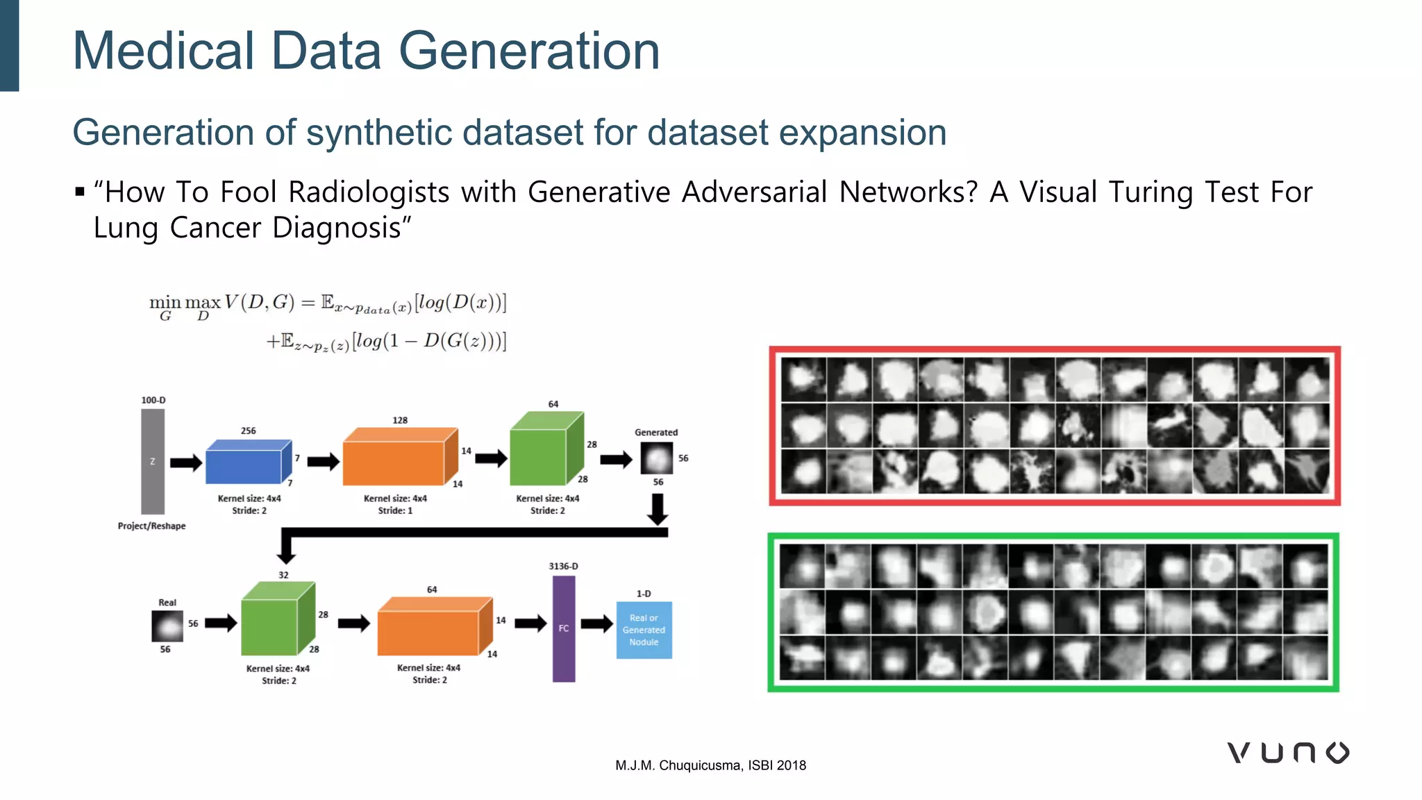 Generation of synthetic dataset for dataset expansion
Medical Data Generation
M.J.M. Chuquicusma, ISBI 2018
▪ “How To Fool Radiologists with Generative Adversarial Networks? A Visual Turing Test For
Lung Cancer Diagnosis”
 