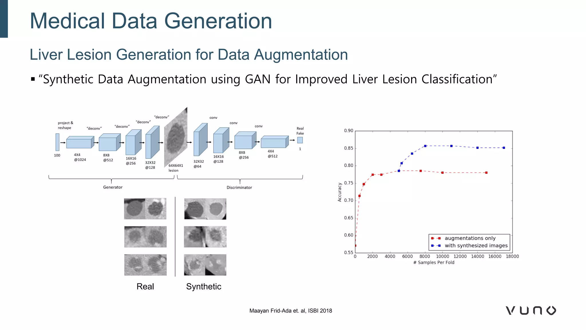 ▪ “Synthetic Data Augmentation using GAN for Improved Liver Lesion Classification”
Liver Lesion Generation for Data Augmentation
Medical Data Generation
Maayan Frid-Ada et. al, ISBI 2018
Real Synthetic
 