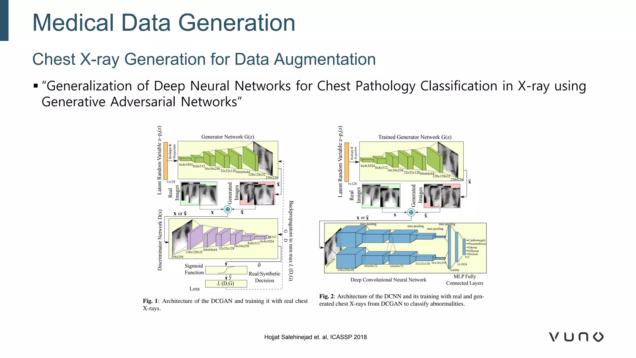 ▪ “Generalization of Deep Neural Networks for Chest Pathology Classification in X-ray using
Generative Adversarial Networks”
Chest X-ray Generation for Data Augmentation
Medical Data Generation
Hojjat Salehinejad et. al, ICASSP 2018
 