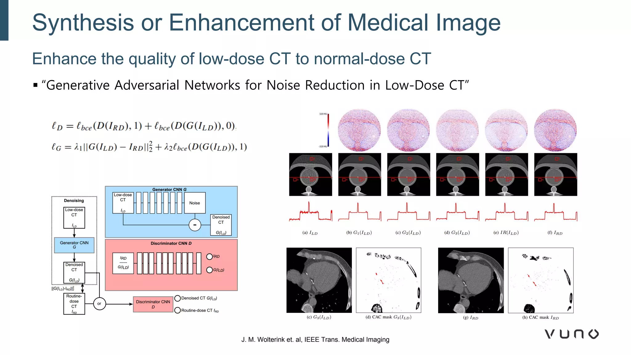 Enhance the quality of low-dose CT to normal-dose CT
Synthesis or Enhancement of Medical Image
J. M. Wolterink et. al, IEEE Trans. Medical Imaging
▪ “Generative Adversarial Networks for Noise Reduction in Low-Dose CT”
 