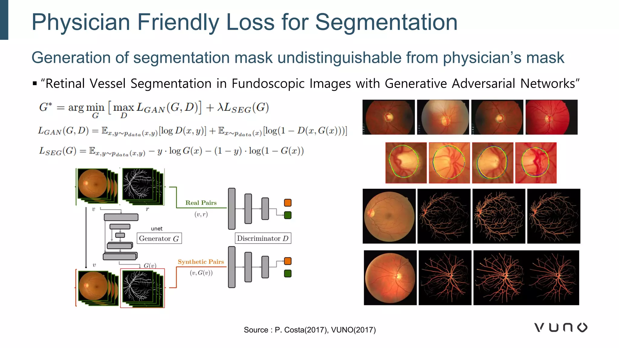 Generation of segmentation mask undistinguishable from physician’s mask
Physician Friendly Loss for Segmentation
Source : P. Costa(2017), VUNO(2017)
▪ “Retinal Vessel Segmentation in Fundoscopic Images with Generative Adversarial Networks”
 