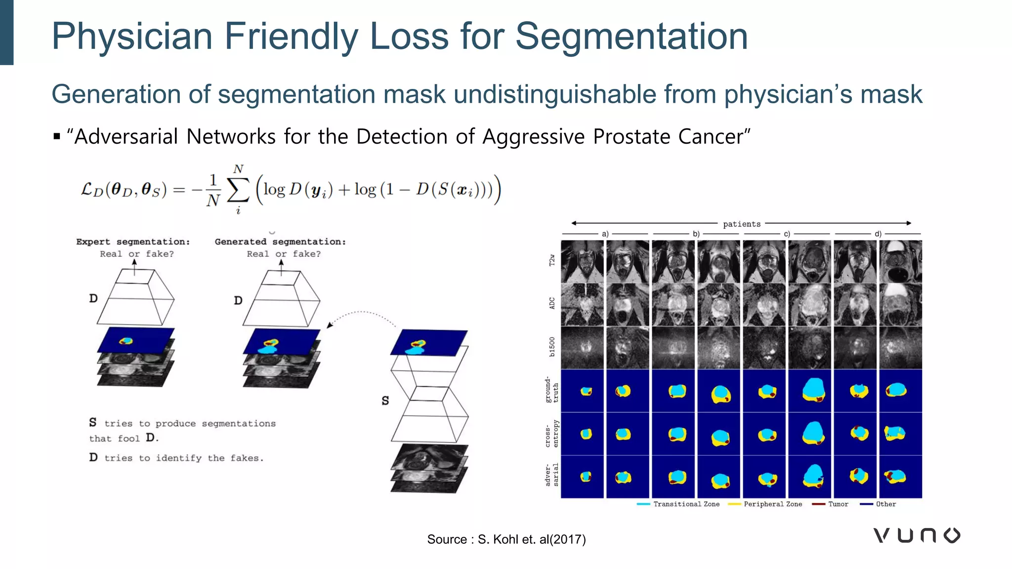 ▪ “Adversarial Networks for the Detection of Aggressive Prostate Cancer”
Generation of segmentation mask undistinguishable from physician’s mask
Physician Friendly Loss for Segmentation
Source : S. Kohl et. al(2017)
 