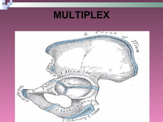 General Anatomy of Joints | PPT