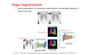 Organ Segmentation
• Organ segmentation is a crucial step to obtain effective computer-aided detection on
Chest X-ray (CXR). Original CXR image Lung field annotation
Dai, Wei, et al. "Scan: Structure correcting adversarial network for chest x-rays organ segmentation." arXiv preprint arXiv:1703.08770 (2017).
(N, 400, 400, 1)
(N, 400, 400, 4)
(N, 400, 400, 4)
(N, 400, 400, 1+4)
 