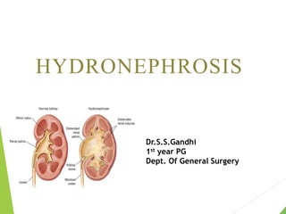 HYDRONEPHROSIS
Dr.S.S.Gandhi
1st year PG
Dept. Of General Surgery
 