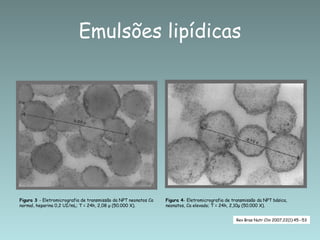 Emulsões lipídicas Figura 3  - Eletromicrografia de transmissão da NPT neonatos Ca normal, heparina 0,2 UI/mL; T = 24h, 2,08 μ (50.000 X). Figura 4 - Eletromicrografia de transmissão da NPT básica, neonatos, Ca elevado; T = 24h, 2,10μ (50.000 X). Rev Bras Nutr Clin 2007;22(1):45--53 