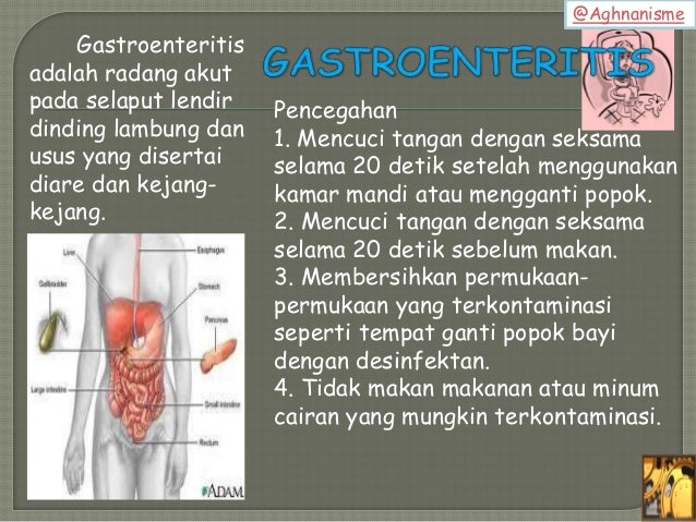 Gangguan dan kelainan pada sistem pencernaan