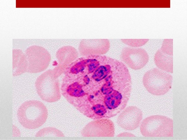 GANGGUAN HAEMOPOIETIK