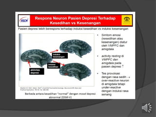 Gangguan Mood 1 insersi Islam (recovered).pptx
