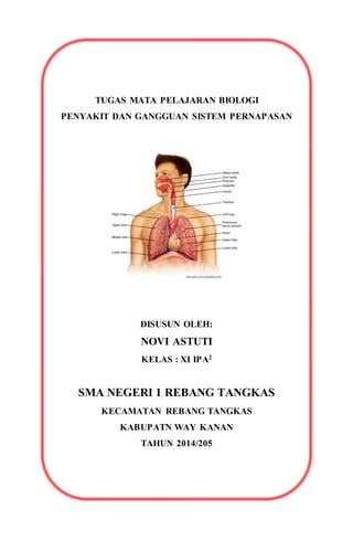 TUGAS MATA PELAJARAN BIOLOGI
PENYAKIT DAN GANGGUAN SISTEM PERNAPASAN
DISUSUN OLEH:
NOVI ASTUTI
KELAS : XI IPA2
SMA NEGERI 1 REBANG TANGKAS
KECAMATAN REBANG TANGKAS
KABUPATN WAY KANAN
TAHUN 2014/205
 