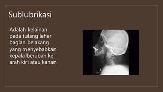 Sublubrikasi
Adalah kelainan
pada tulang leher
bagian belakang
yang menyebabkan
kepala berubah ke
arah kiri atau kanan
 