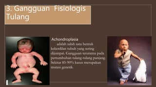 Achondroplasia
adalah salah satu bentuk
kekerdilan tubuh yang sering
dijumpai. Gangguan terutama pada
pertumbuhan tulang-tulang panjang.
Sekitar 85-90% kasus merupakan
mutasi genetik.
3. Gangguan Fisiologis
Tulang
 